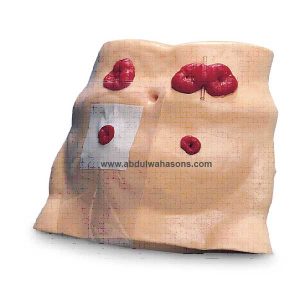 Ostomy Care Model